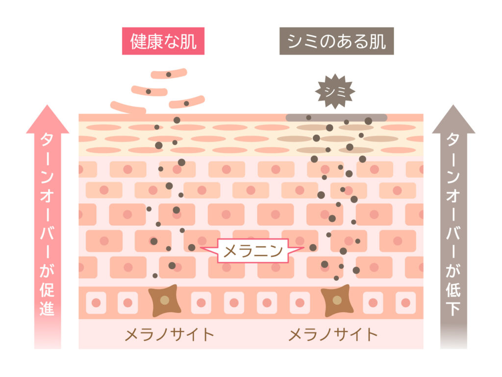 糖化によって起こる肌トラブル